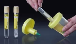 Disposable Plastic Sterile Urine Container factory